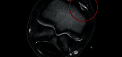 Clinical Image - O-scan equine: Fetlock Arthropathy