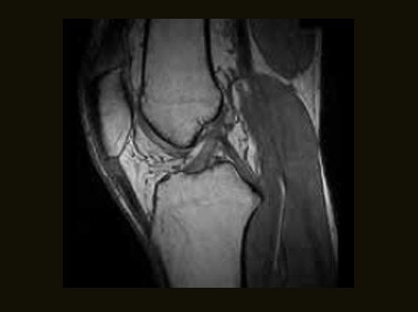 S-scan - Knee 3D SHARC Sagittal