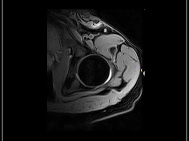 G-scan Brio - Shoulder - XBone Axial