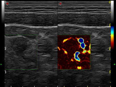 Clinical Image - MyLab<sup>™</sup>Eight Platform - High Sensitive Hemodynamics Analysis