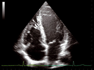 Clinical Image - MyLab<sup>™</sup>Twice - Heart