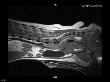 Clinical Image - Vet-MR - Lumbar-sacral - SE T1 weighted dorsal