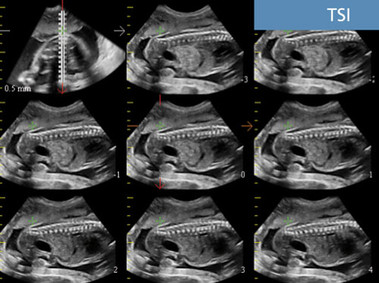 Clinical Image - MyLab<sup>™</sup>Seven - TSI Imaging