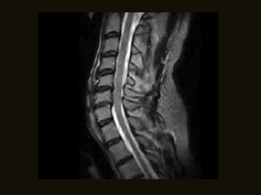 S-scan - C-spine FSE T2 Sagittal