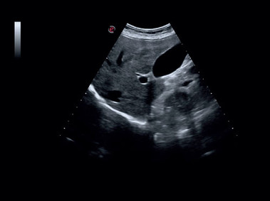 Immagine clinica - MyLab<sup>™</sup>Six - Fegato (XView - MView)