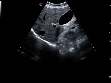 Clinical Image - MyLab<sup>™</sup>Seven - Abdominal overview
