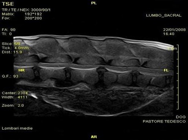 Clinical Image - Vet-MR - Lumbar-sacral - SE T1 weighted dorsal