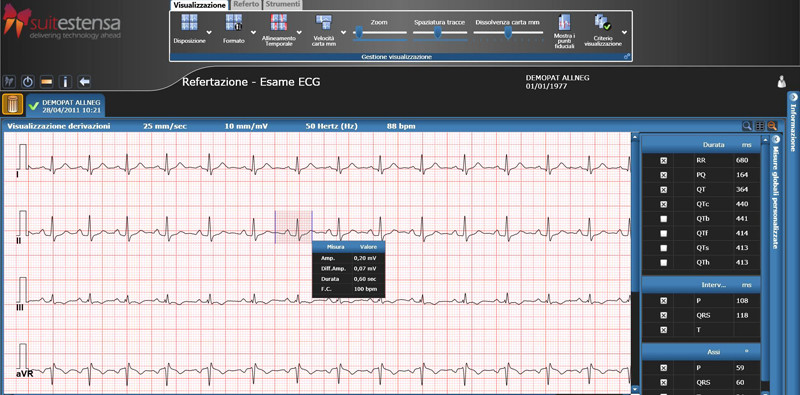 Ecocardiograma 10 de Código icd para informe
