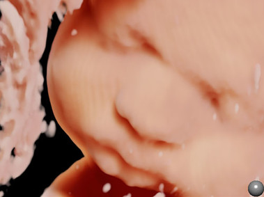 Clinical Image - MyLab<sup>™</sup>Eight Platform - 4D Imaging Obstetrics (XLight)