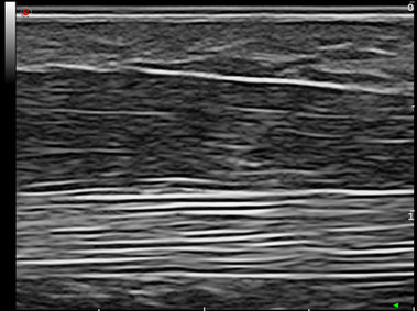 Clinical Image - MyLab<sup>™</sup>Eight Platform - High Frequency Imaging