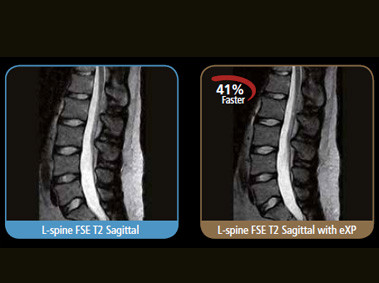 S-scan - L-spine FSE T2 Sagittal with eXP