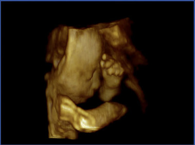 Clinical Image - MyLab<sup>™</sup>Twice - Fetal Face (4D view)