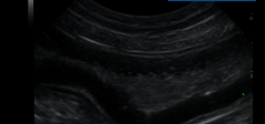 Clinical Image - MyLab™EightVET Abdomen - B-Mode