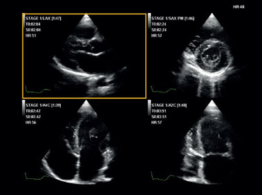 Immagine clinica - MyLab<sup>™</sup>Six - Imaging per ecografia da stress