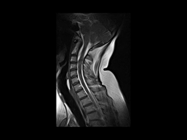 G-scan Brio - Cervical - 2d - HYCE-S