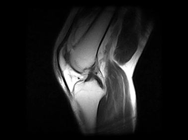 G-scan Brio - Knee - 2d - HYCE-S