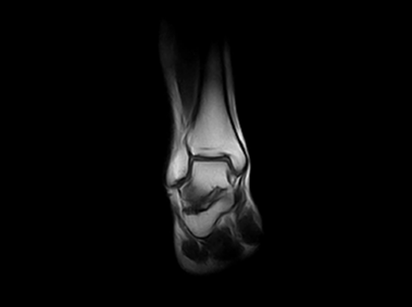 G-scan Brio - Ankle - 2d - HYCE-S-2
