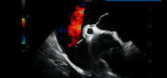 Clinical Image - MyLab™EightVET - Cardio CFM