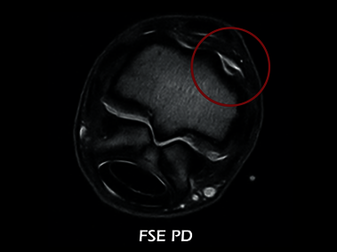 Clinical Image - O-scan equine: Fetlock Arthropathy