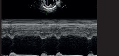 Clinical Image - MyLab™EightVET - Cardio M-Mode