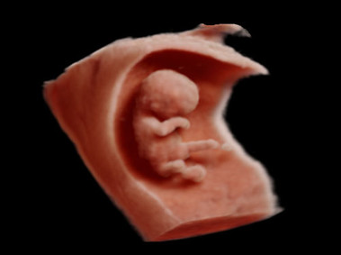 Clinical Image - MyLab<sup>™</sup>Seven - Volumetric Imaging
