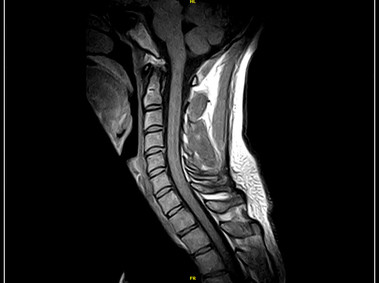 G-scan Brio - CSpine - SE T1 Sagittal