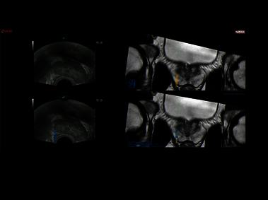 Clinical Image - MyLab<sup>™</sup>Eight eXP - Prostate Biopsy Sample Tracking