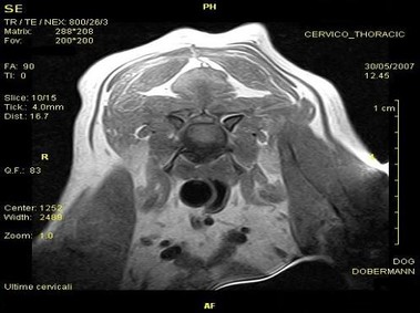 Clinical Image - Vet-MR - Cervo-thoracic - SE T1 weighted dorsal