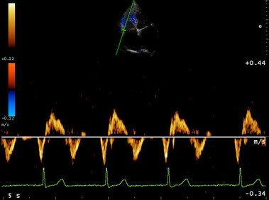 Clinical Image - MyLab<sup>™</sup>Eight Platform - Heart (TV)