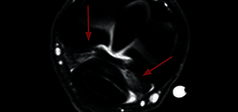 Clinical Image - O-scan equine: Fetlock Arthropathy