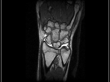 G-scan Brio - Wrist - 3D SHARC Coronal