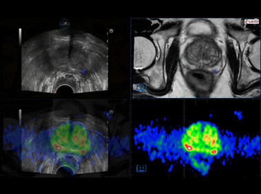 Clinical Image - MyLab<sup>™</sup>Eight Platform - Multi-Dataset Fusion Imaging