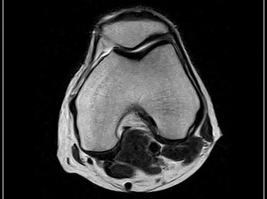 G-scan Brio - Knee - FSE T2 Axial