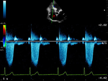 Clinical Image - MyLab<sup>™</sup>Eight Platform - Heart (CW)