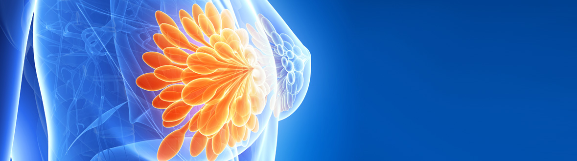 Healthcare IT Breast Imaging