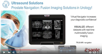 Prostate Navigation and more