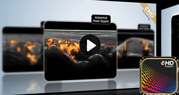 video 3