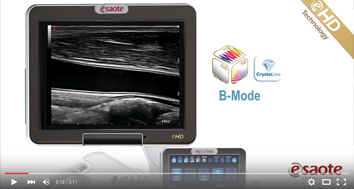linear imaging eHD