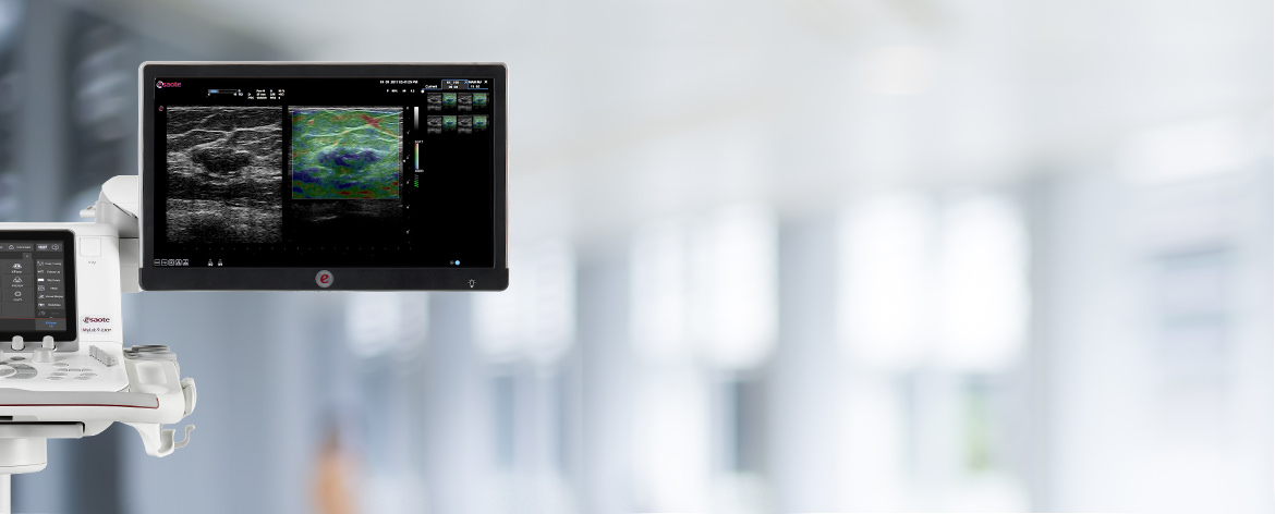 mylab9-ultrasound-home.jpg