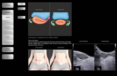 MyLibrary GYNAECOLOGY