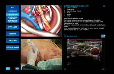 MyLibrary REGIONAL ANAESTHESIA