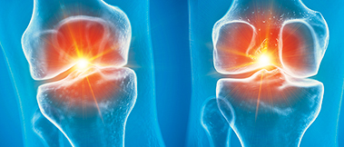 Orthopaedics