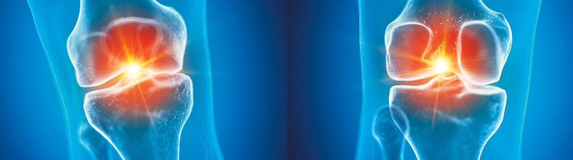 Healthcare IT Orthopedics