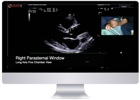 Bidimensional echocardiographic exam in dogs