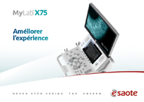 Brochure - MyLab<sup>™</sup>X75 [PDF - 1.3Mb] - FR