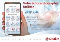Plaquette Solutions Esaote en Cardiologie