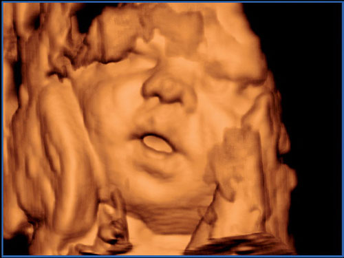 Ultrasound Systems Ultrasound Systems