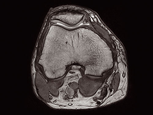 O-scan - Knee 3D SHARC Axial