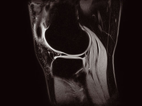 O-scan - Knee XBONE Sagittal